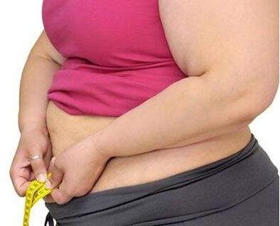  痛风患者大多体重超标比较肥胖?